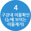 회구강내이물확인(눈에 보이는 이물제거)