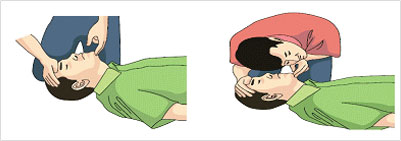 성인 심폐소생술에 관한 이미지이며 기도를 확보합니다.